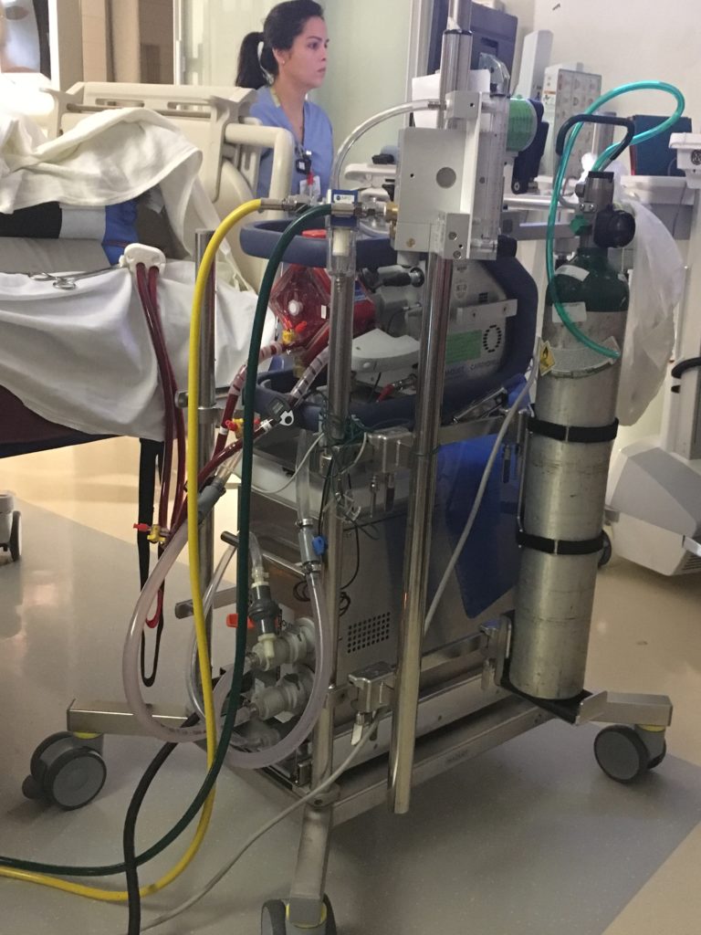 This Mommy's Heart - My PPCM Story - ECMO machine